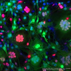 fibroblasts